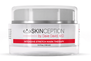 Intensive Stretch Mark Therapy Singapore Review