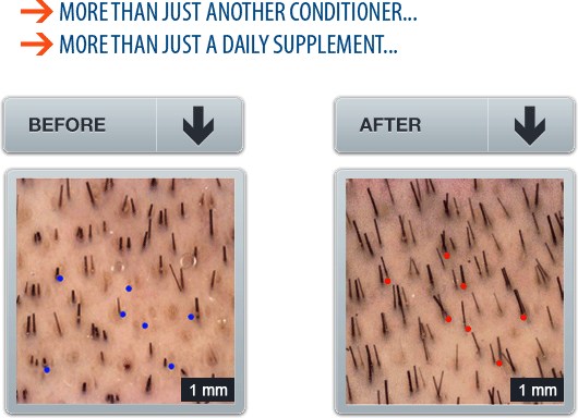 How Profollica works