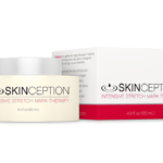 Intensive Stretch Mark Therapy Singapore Review